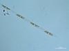 Photo of Pseudo-nitzschia spp. (large-celled)